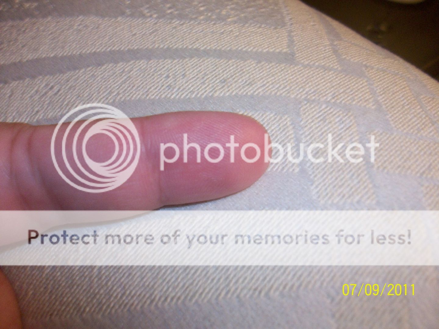 Burnt finger help. BabyGaga